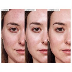 Glow Recipe Avocado Ceramide Recovery Serum 30 ml Восстанавливающая сыворотка с авокадо и керамидами